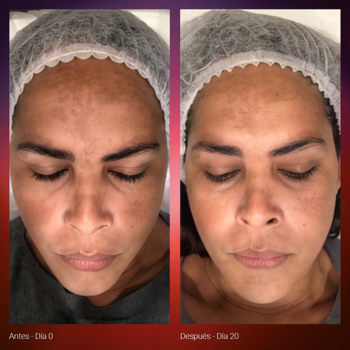 Radiant Dual Serum 30ml.